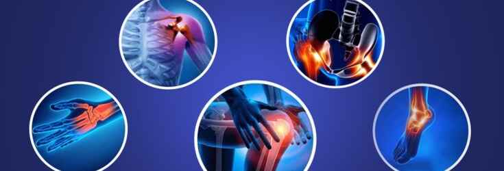 Orthopaedic Implants & Instruments