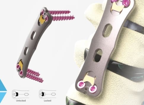 Why Choose Lotus Overseas - Orthopedic Implants Manufacturing